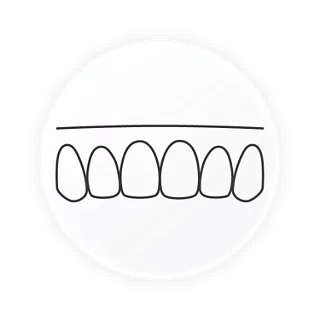 Trimline